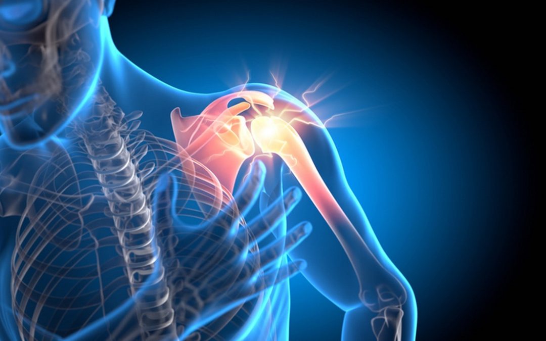 Theology of a Broken Shoulder: Admonishment and Advice for Church Leaders